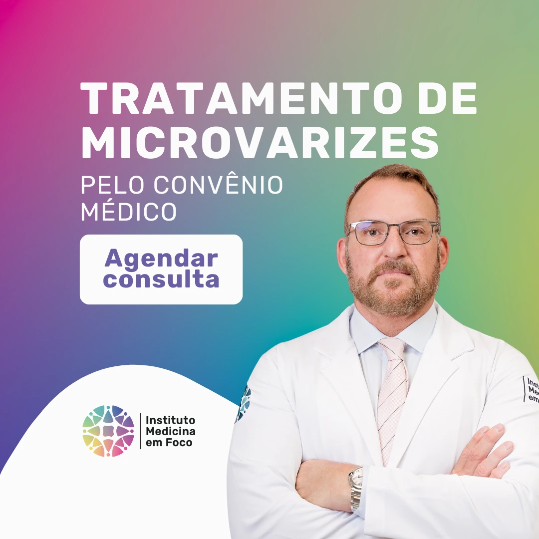 Faça o seu tratamento para microvarizes pela Omint Saúde com o Dr. João Maffei