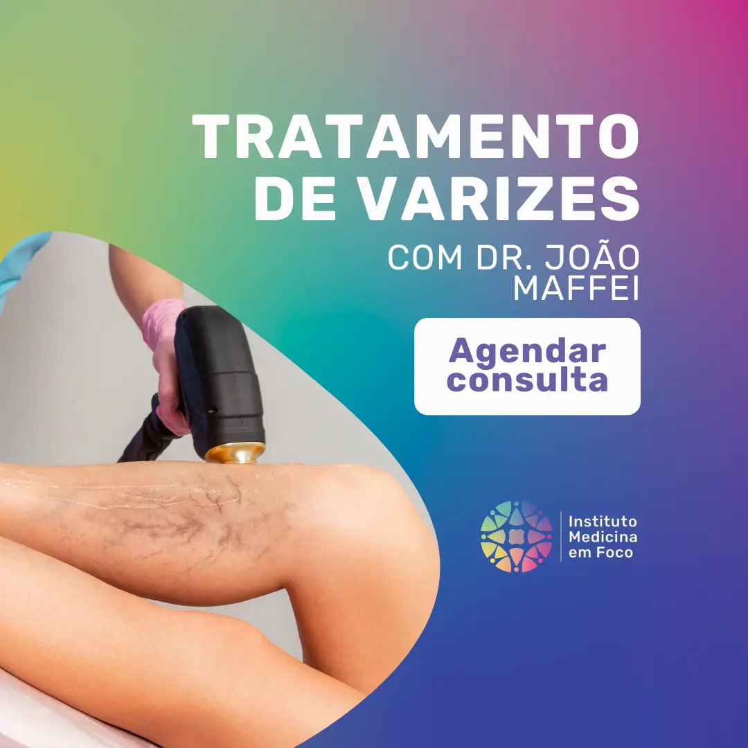 Tratamento de varizes com o angiologista Dr. João Maffei