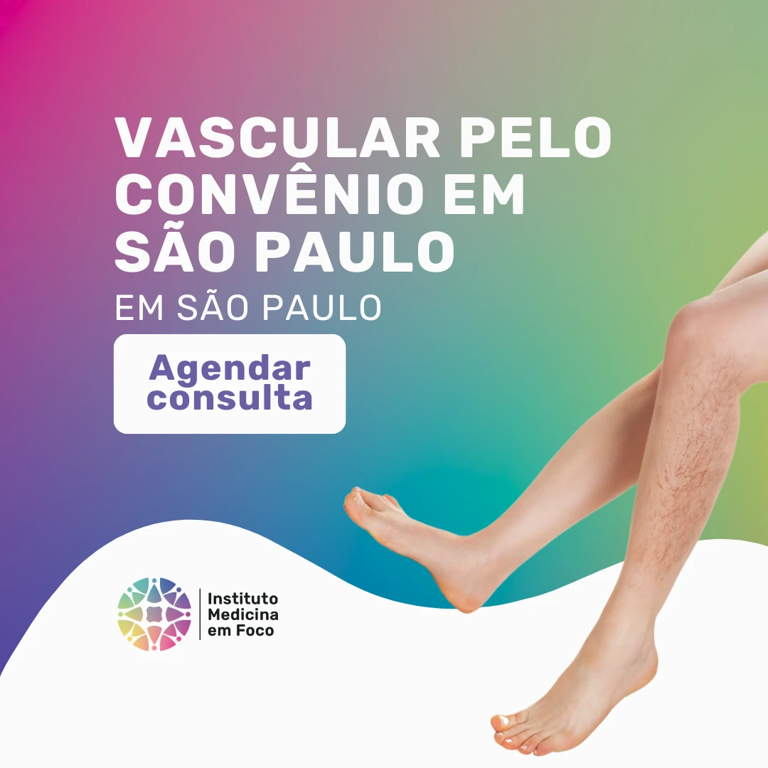 Consulta vascular com Dr Joao Maffei para fazer o seu tratamento a laser para varizes Allianz