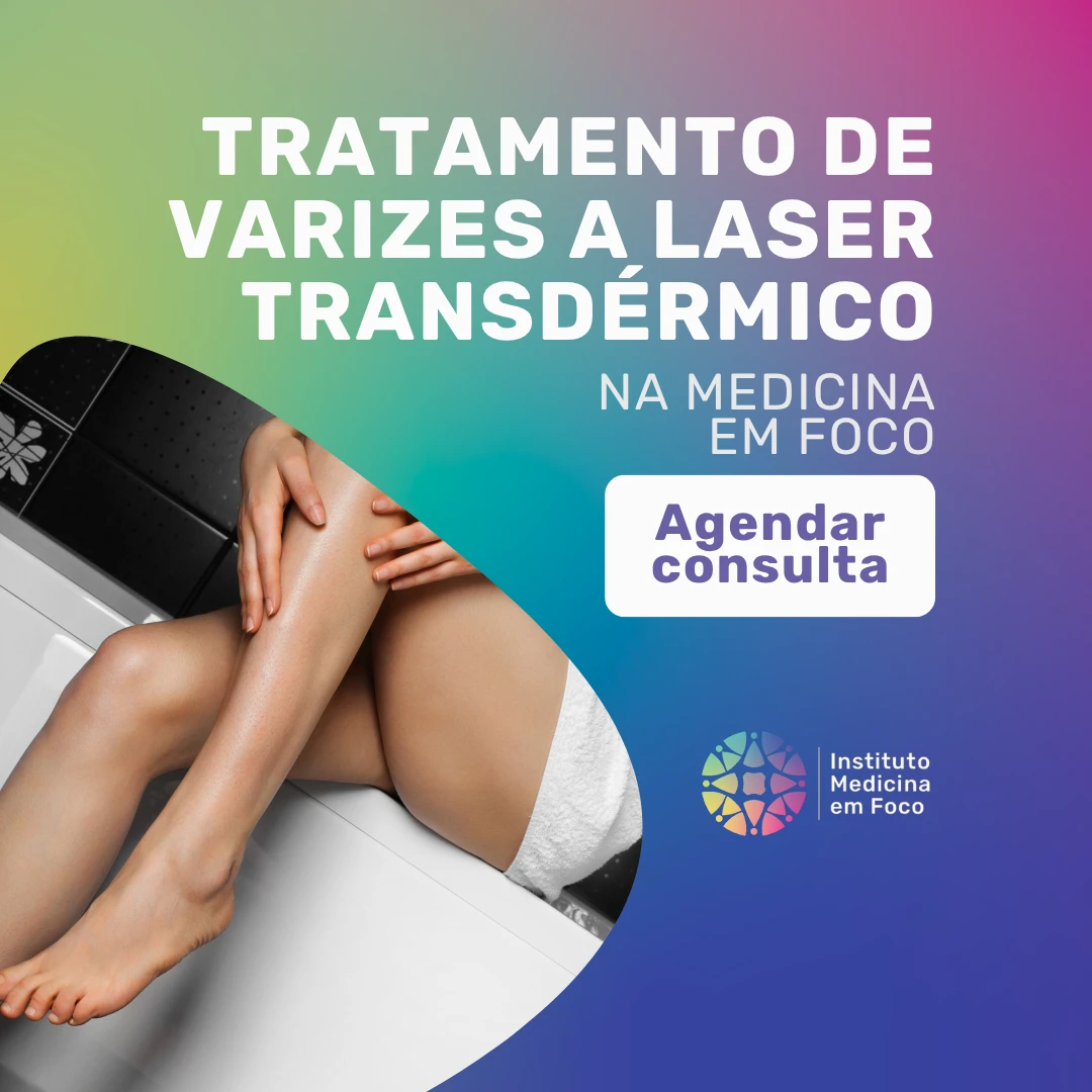 Agende a sua Consulta vascular para realizar o seu Tratamento de varizes a laser transdérmico em São Paulo