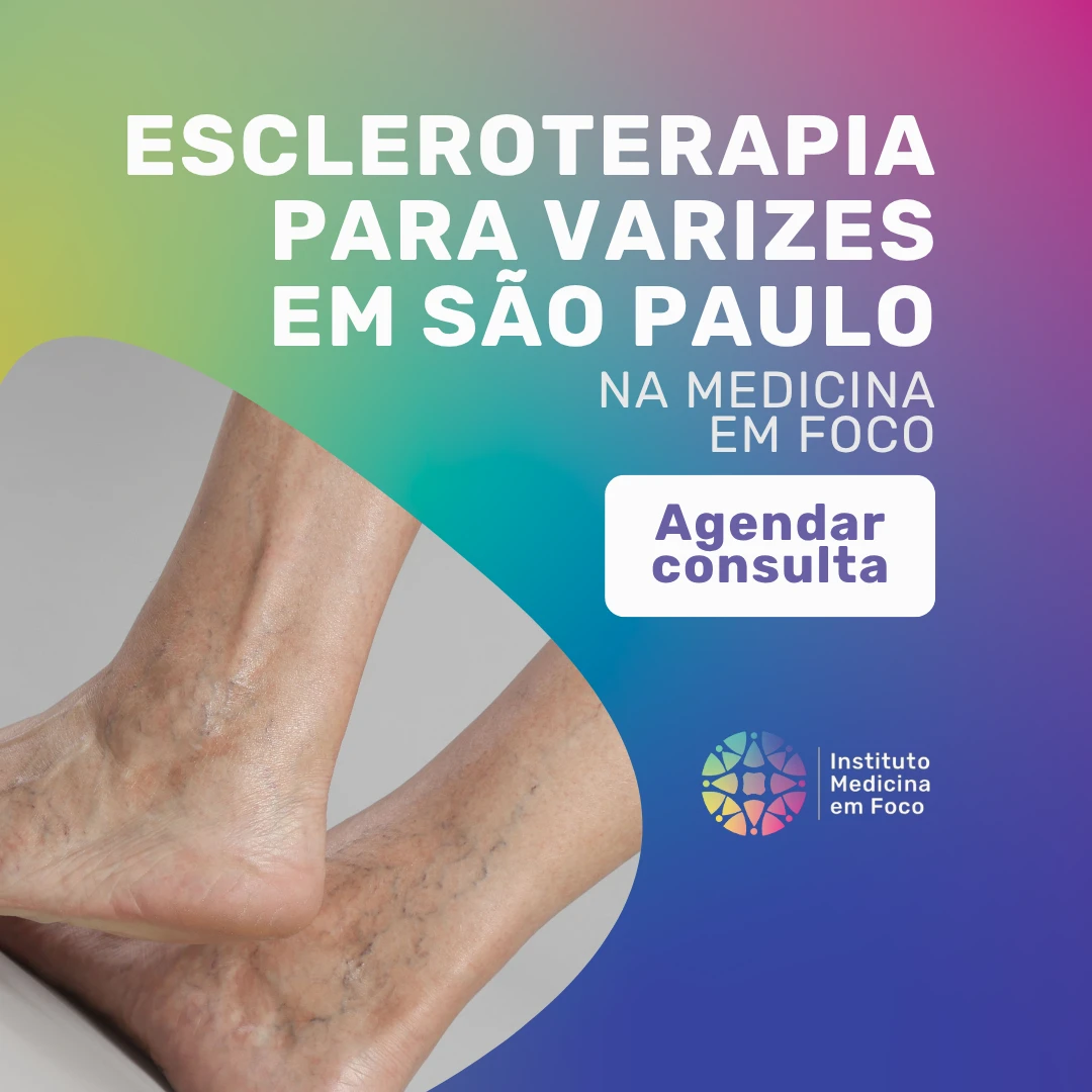 Agende a sua Consulta vascular para Escleroterapia para varizes em São Paulo