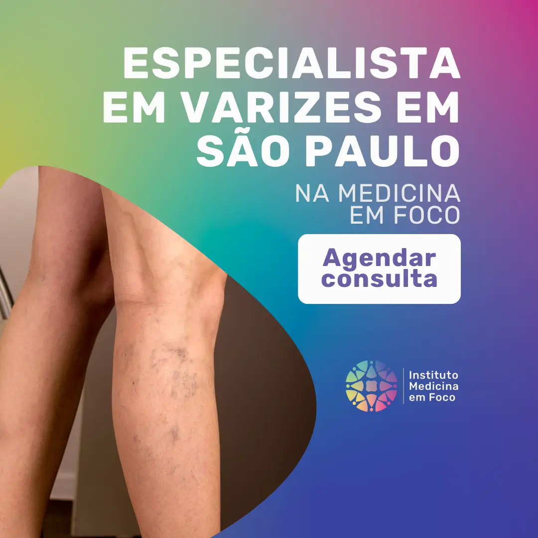Agende a sua Consulta vascular para Tratamento endolaser para varizes em São Paulo
