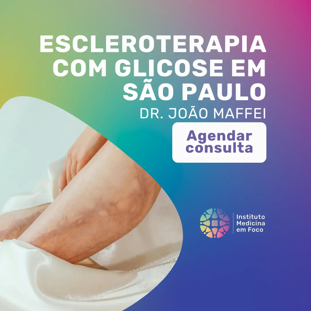 Agende sua Consulta vascular em São Paulo para fazer seu tratamento de Escleroterapia com Glicose com o Dr João Maffei
