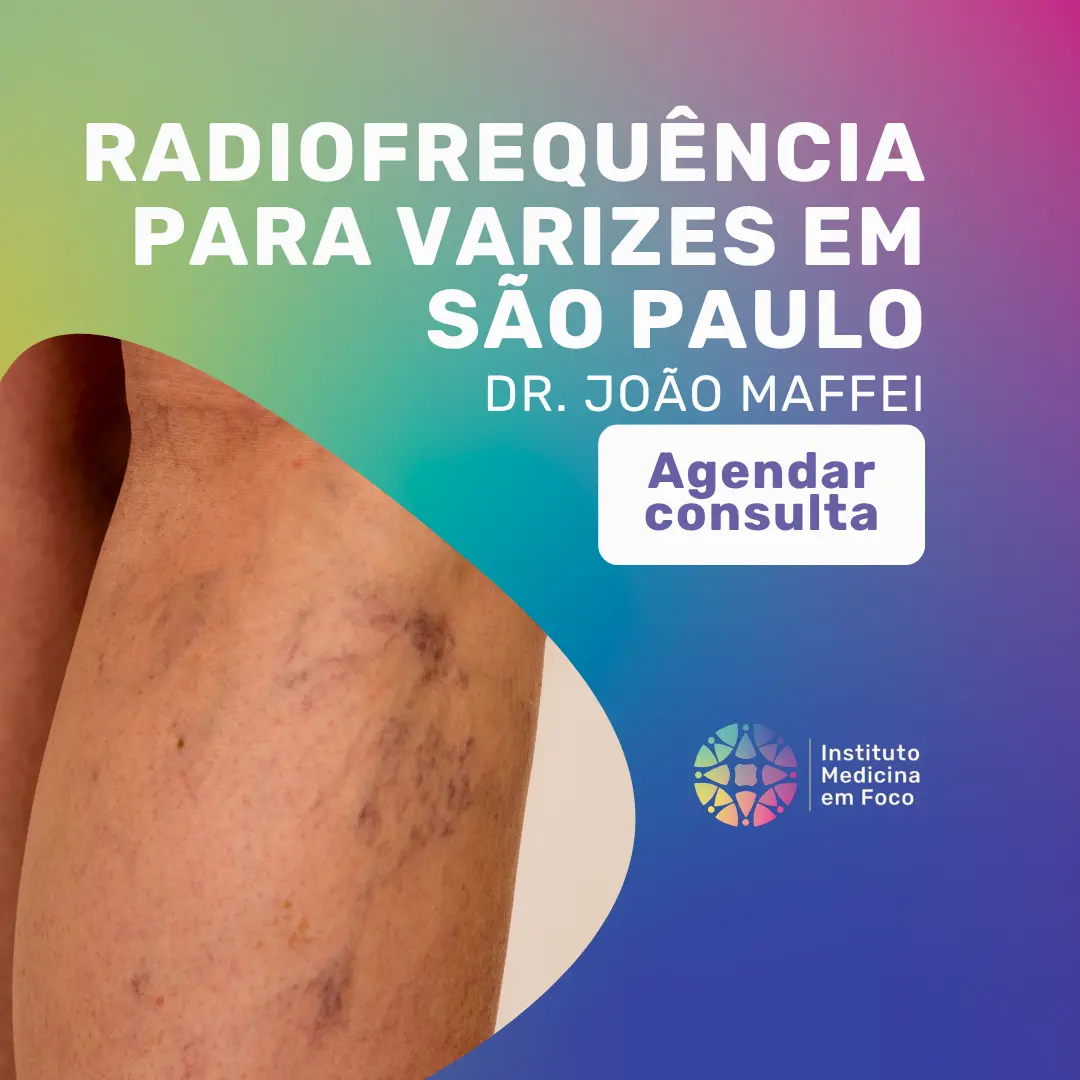 Agende sua Consulta vascular em São Paulo para fazer seu tratamento de Radiofrequência para varizes com o Dr João Maffei