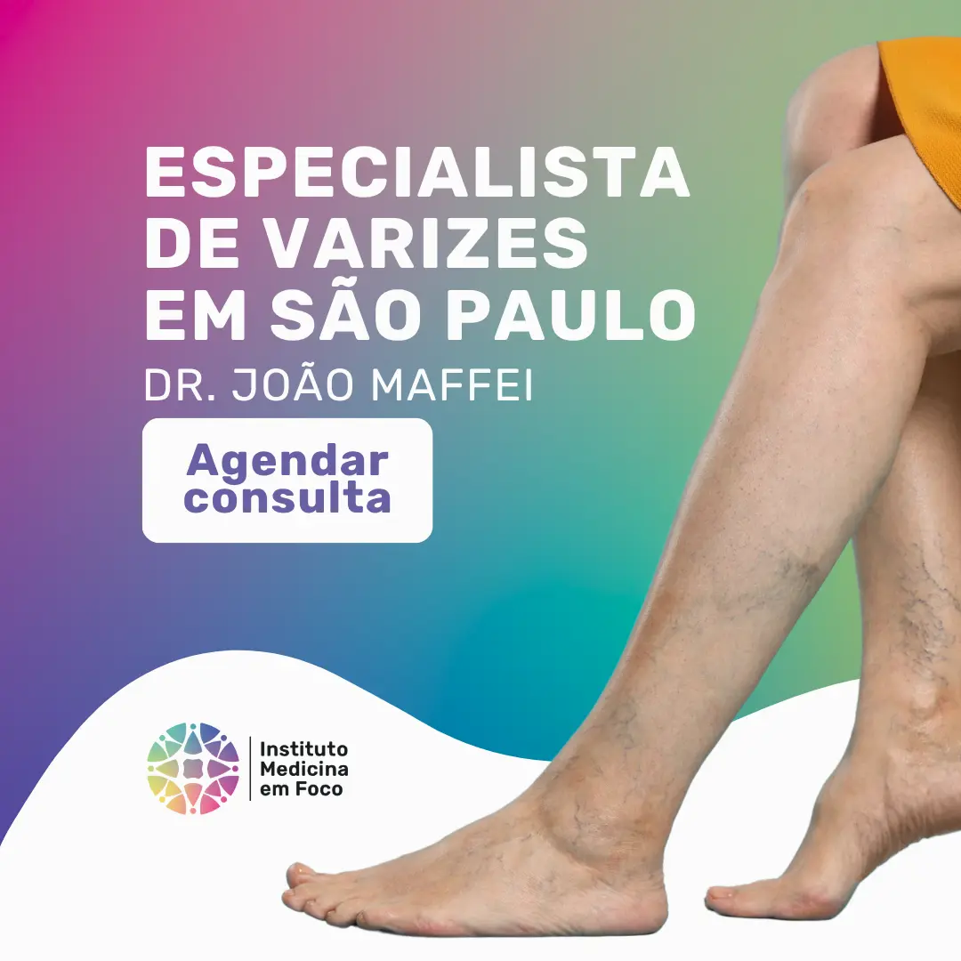 Agende sua consulta com o Dr Joao Maffei para realizar o seu Tratamento de Radiofrequência para varizes em São Paulo