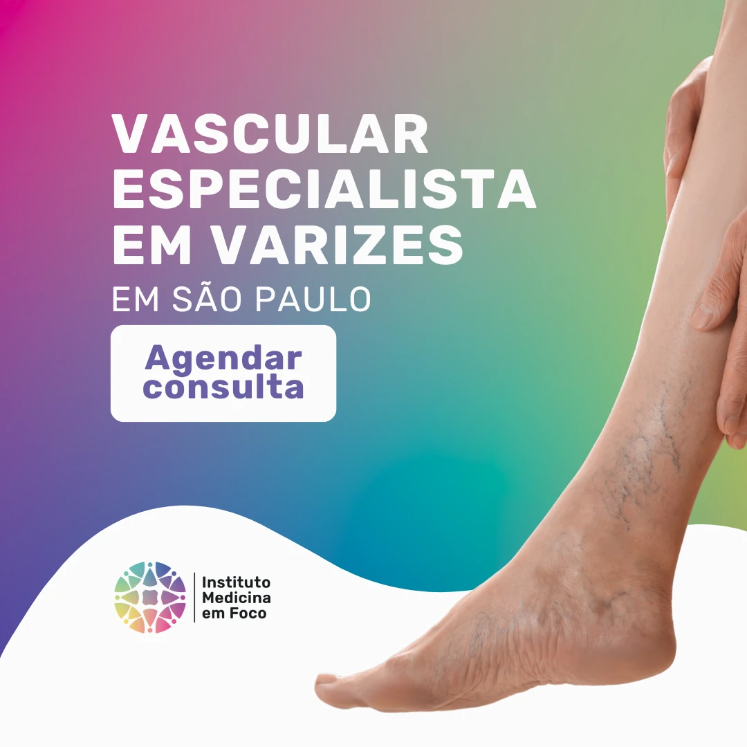 Agende sua consulta com o Dr Joao Maffei para realizar o seu Tratamento de varizes com Escleroterapia para varizes em São Paulo