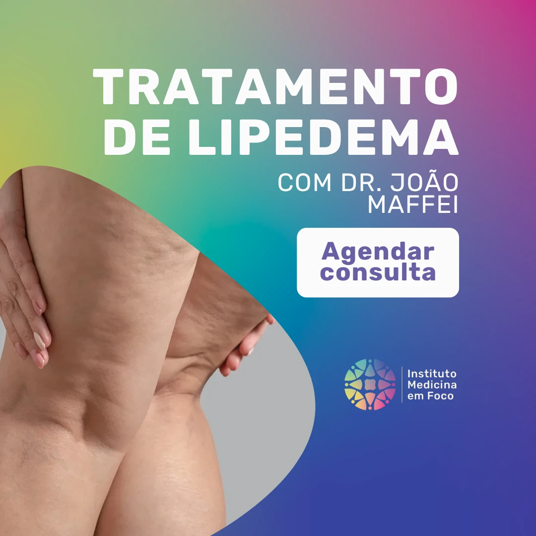Tratamento de lipedema com o angiologista Dr. João Maffei
