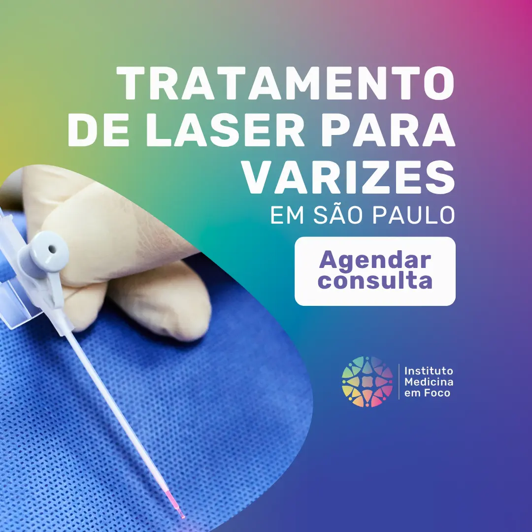 Agende o seu tratamento de laser para varizes em São Paulo com o Dr João Maffei