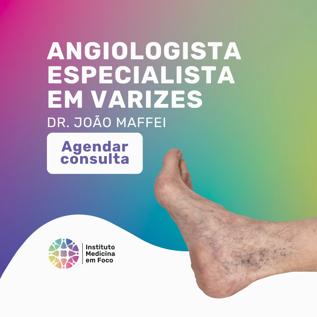 Agende sua consulta com o Dr. João Maffei, angiologista especialista em varizes, e faça seu tratamento escleroterapia com espuma para varizes em São Paulo