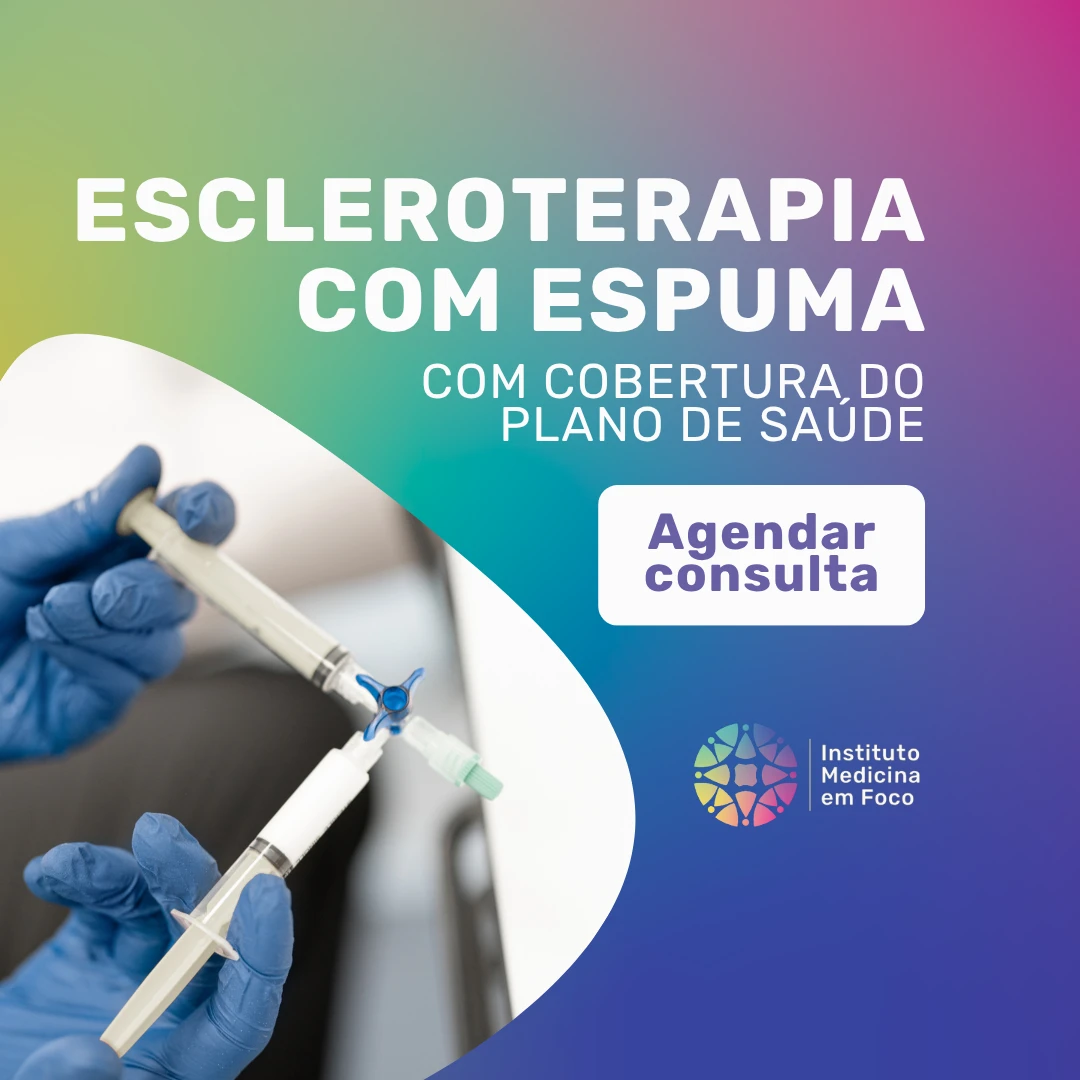 Faça a sua Escleroterapia com espuma com o Dr. João Maffei