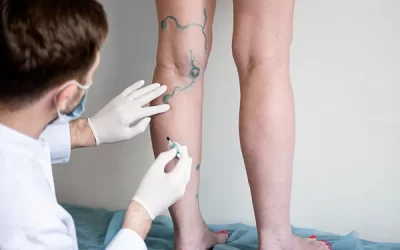 Cirurgião Vascular: médico que cuida dos vasos sanguíneos