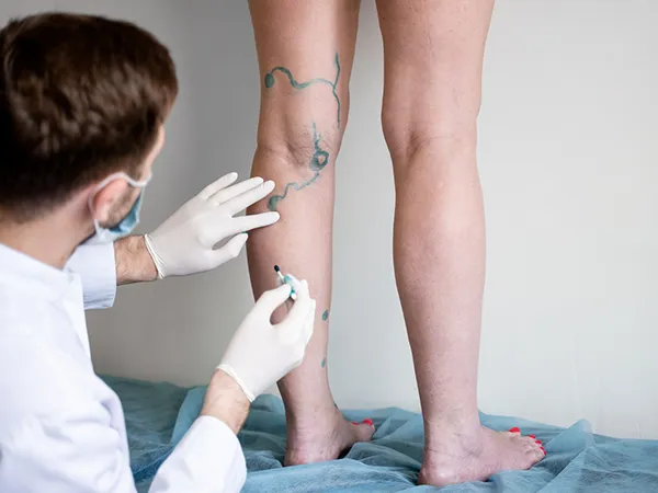 Cirurgião Vascular: médico que cuida dos vasos sanguíneos