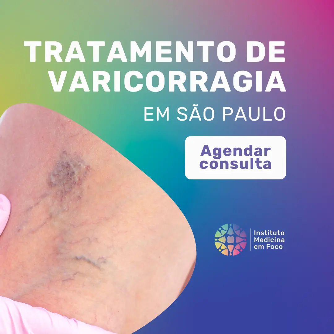 Agende a sua consulta com Angiologista em São Paulo com o Dr João Maffei para tratar Varicorragia