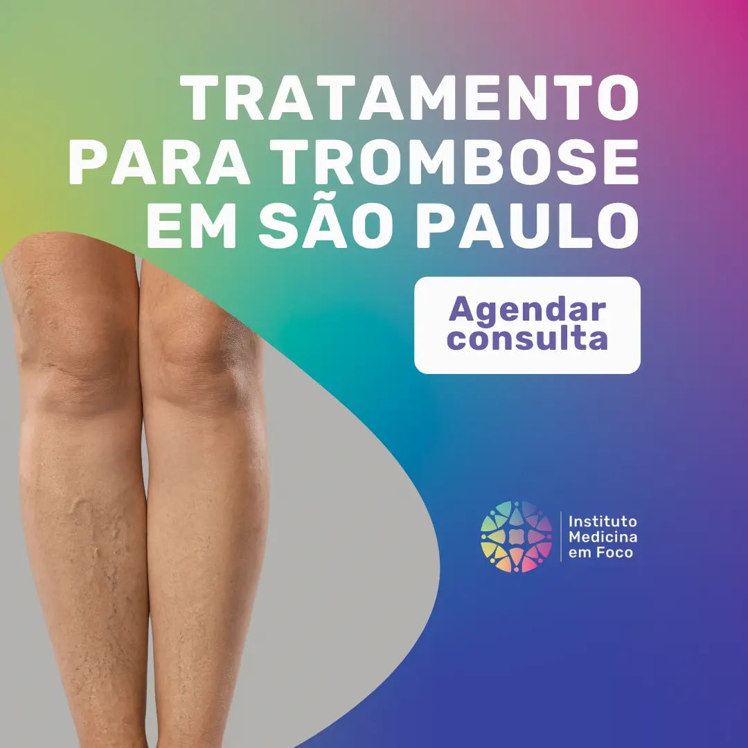 Agende sua consulta com o Dr. João Maffei, Cirurgião Vascular em São Paulo, para o Melhor tratamento para trombose em São Paulo