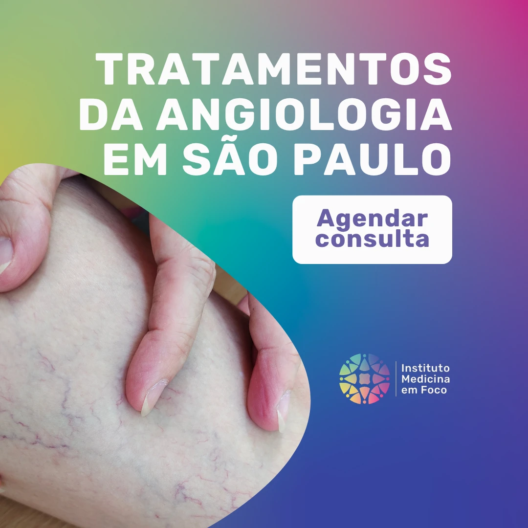 Agende sua consulta com o Dr. João Maffei, angiologista em São Paulo, para o Melhor tratamento para varizes e vasinhos em São Paulo