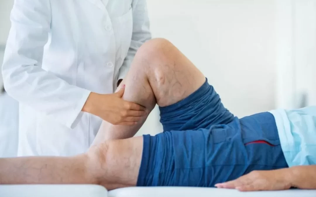 Saúde vascular: cuidados do Dr. João Maffei