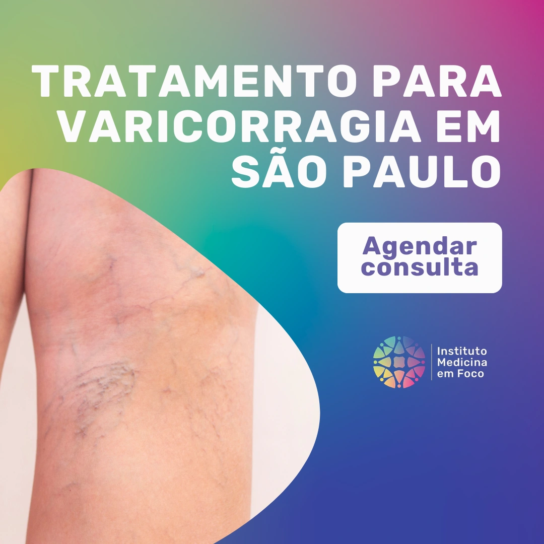 Agende sua consulta com o Dr. João Maffei, Angiologista em São Paulo, para tratamento para varicorragia