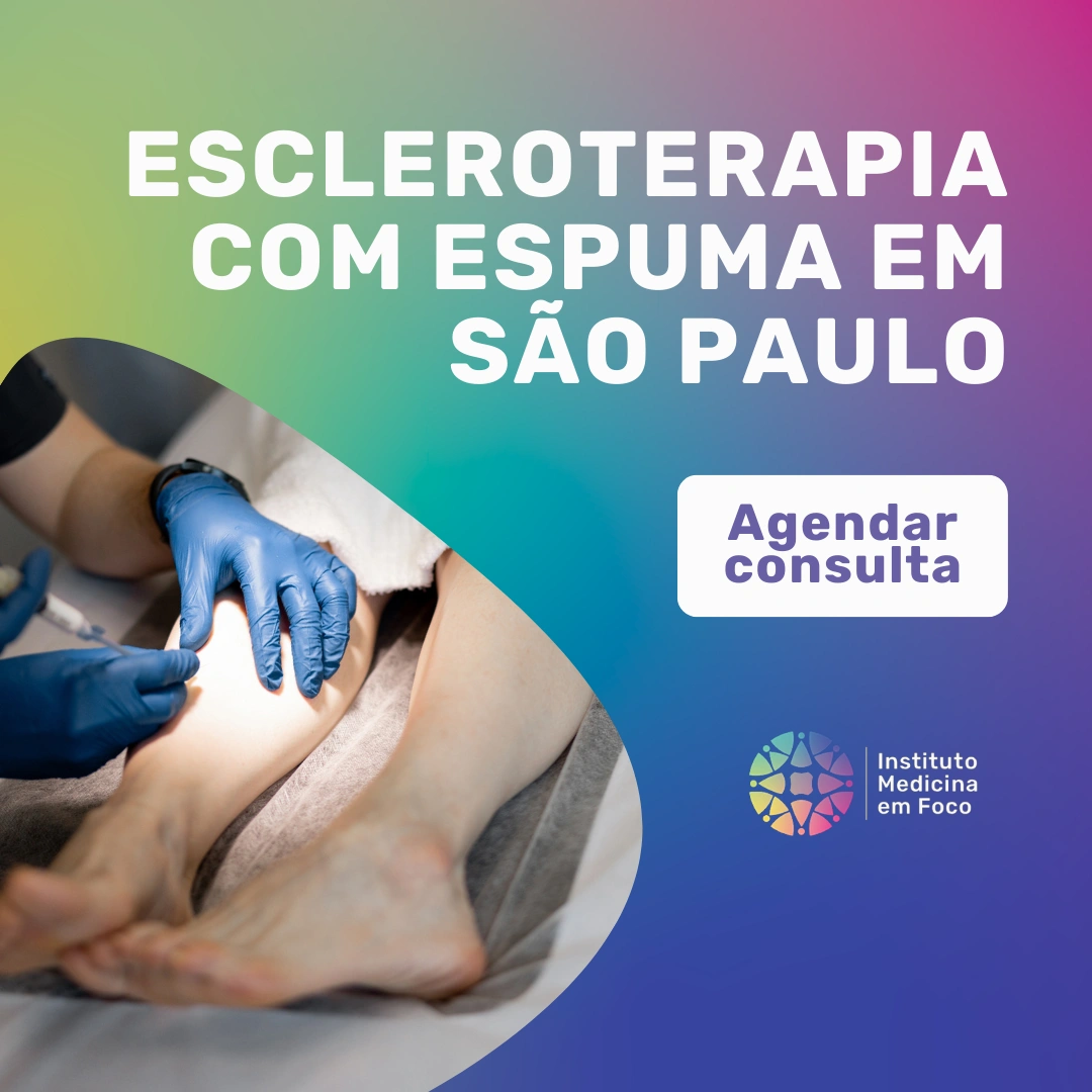 Agende sua consulta com o Dr. João Maffei, Angiologista em São Paulo, para tratar seus vasos e varizes com a escleroterapia com espuma em são paulo