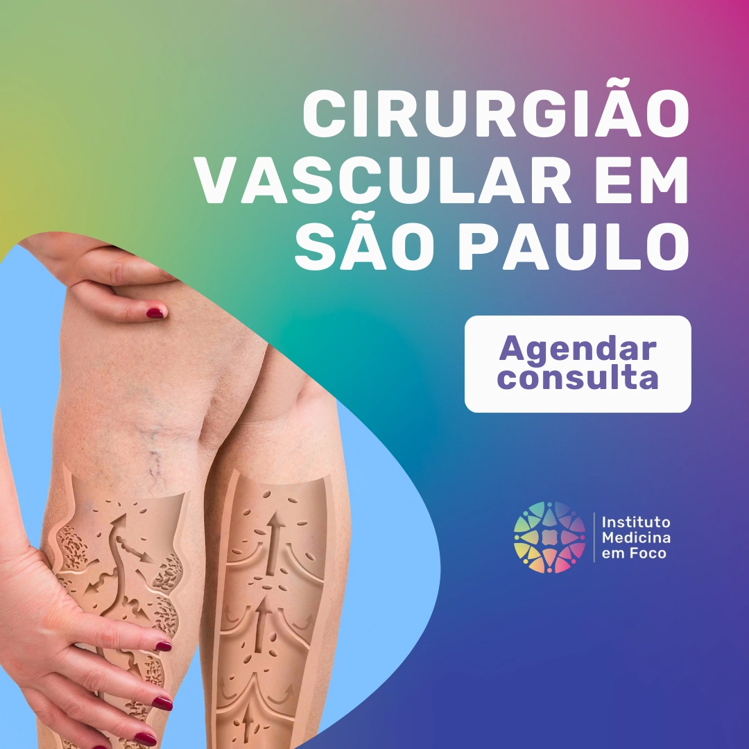 Agende sua consulta com o Dr. João Maffei, Cirurgião Vascular em São Paulo, para tratar peso nas pernas