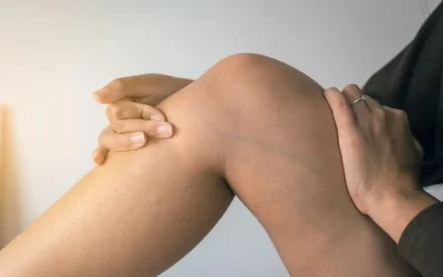 Melhore sua saúde vascular com a escleroterapia com glicose