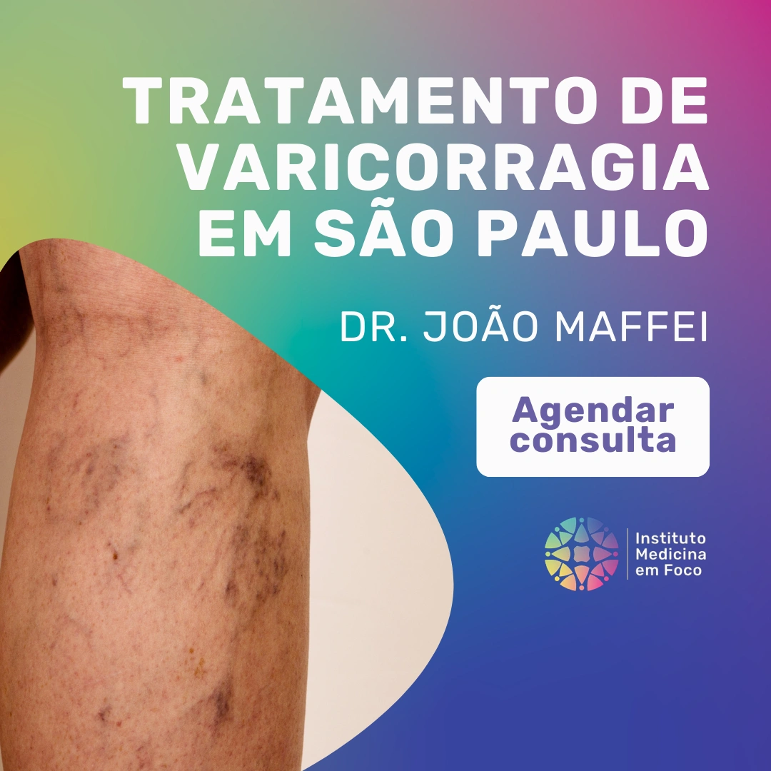 Agende sua consulta com o especialista em varizes Dr. João Maffei, Cirurgião Vascular e Angiologista, para tratamento de varicorragia em são paulo