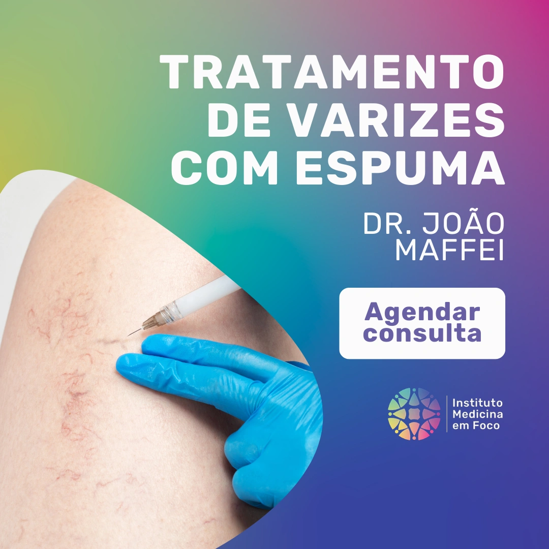 Agende sua consulta com o especialista em varizes Dr. João Maffei, Cirurgião Vascular e Angiologista, para tratamento de varizes com espuma