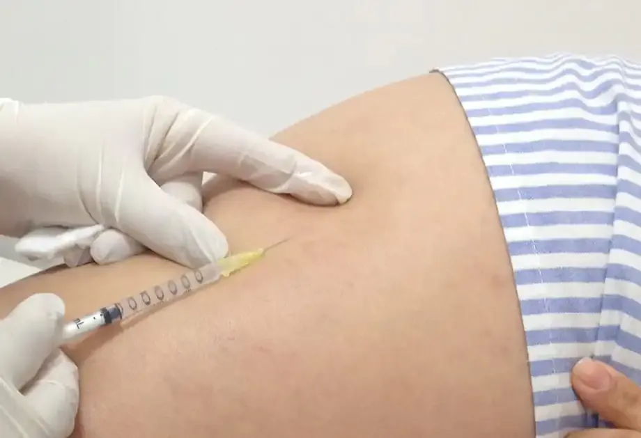 Escleroterapia com glicose: indicação e resultado