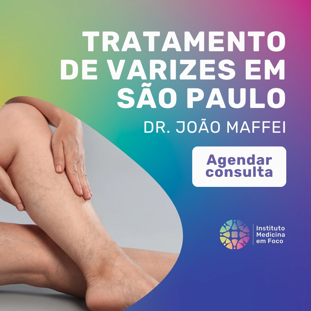 Varizes após emagrecimento: veja o que mudou no seu corpo