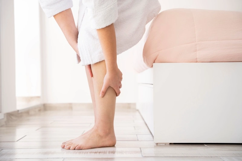 Varizes após emagrecimento: veja o que mudou no seu corpo