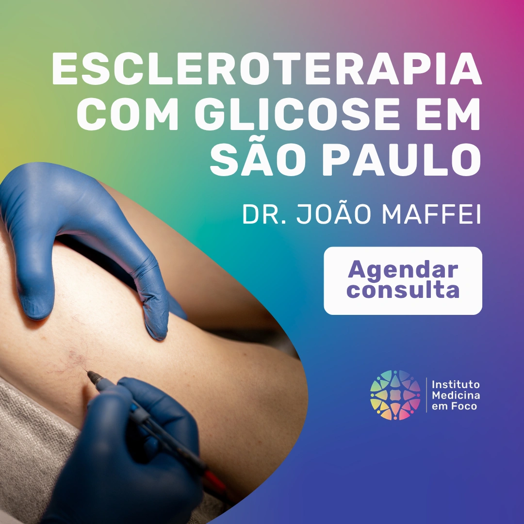 Escleroterapia com glicose: tratamento de vasinhos e varizes
