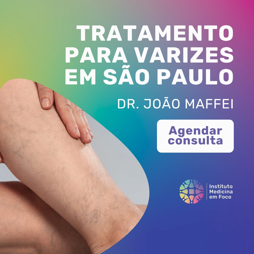 Varizes têm cura? O que a ciência diz sobre o tratamento