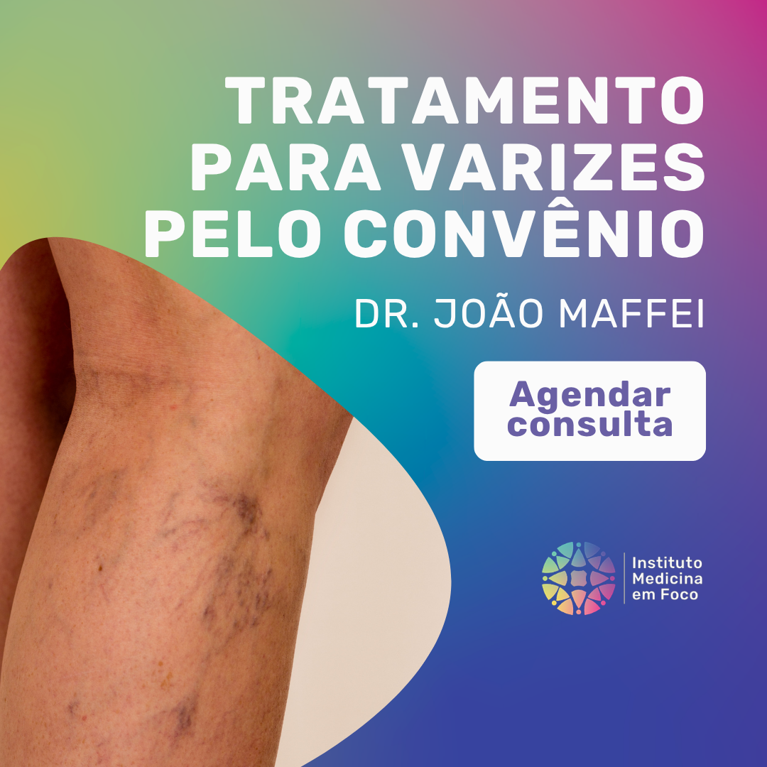 Plano de saúde cobre tratamento de varizes? Guia completo