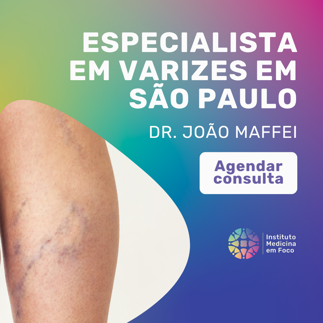 Especialista em varizes em São Paulo: como escolher?